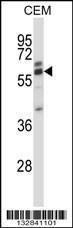 Anti-CORO2A Rabbit Polyclonal Antibody