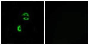 Anti-LDLRAD3 Rabbit Polyclonal Antibody