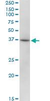 Anti-RHOXF2 Mouse Polyclonal Antibody