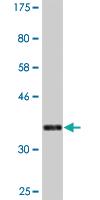 Anti-DMC1 Mouse Monoclonal Antibody [clone: 4A10]