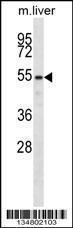 Anti-LCK Rabbit Polyclonal Antibody (HRP (Horseradish Peroxidase))