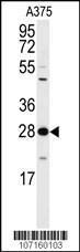 Anti-14-3-3 delta/zeta Rabbit Polyclonal Antibody (AP (Alkaline Phosphatase))