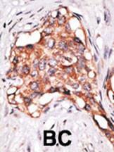 Anti-GDF3 Rabbit polyclonal antibody