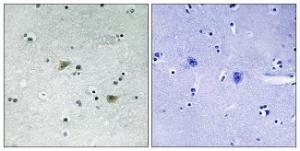 Immunohistochemical analysis of paraffin-embedded human brain using Anti-Src (phospho Ser75) Antibody. The right hand panel represents a negative control, where the antibody was pre-incubated with the immunising peptide.