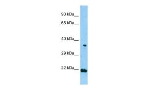 Anti-TNIP2 Rabbit Polyclonal Antibody