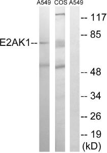 Anti-EIF2AK1 antibody