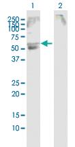 Anti-SLC22A12 Rabbit Polyclonal Antibody