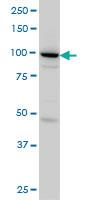 Anti-SH3D19 Mouse Monoclonal Antibody [clone: 5C7]