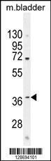 Anti-CL029 Rabbit Polyclonal Antibody (Biotin)