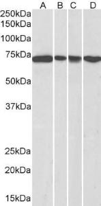 Anti-DDX5 Antibody (A84012) (0.3µg/ml) staining of NIH3T3 (A), HeLa (B), A431 (C) and Jurkat (D) nuclear lysates (35µg protein in RIPA buffer). Detected by chemiluminescence.