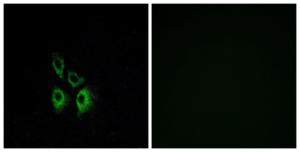 Immunofluorescence analysis of A549 cells using Anti-ADRA1A Antibody. The right hand panel represents a negative control, where the antibody was pre-incubated with the immunising peptide.