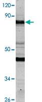 Anti-NCAPH Rabbit Polyclonal Antibody