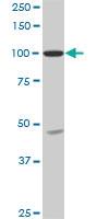 Anti-SH3D19 Mouse Monoclonal Antibody [clone: 5C7]