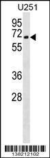 Anti-CORO2B Rabbit Polyclonal Antibody (Biotin)