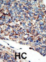 Anti-PI3KC2G Rabbit Polyclonal Antibody