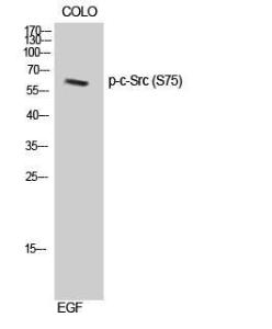 Western blot analysis of COLO cells using Anti-Src (phospho Ser75) Antibody