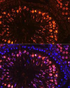 Anti-Histone H1 antibody