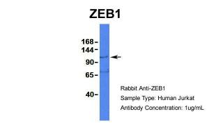 Anti-ZEB1 Rabbit Polyclonal Antibody