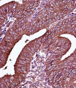 Anti-ESR1 Rabbit Polyclonal Antibody (PE (Phycoerythrin))