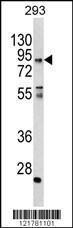 Anti-CCHCR1 Rabbit Polyclonal Antibody (APC (Allophycocyanin))