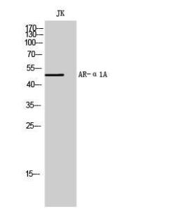 Western blot analysis of JK cells using Anti-ADRA1A Antibody