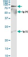 Anti-IDS Rabbit Polyclonal Antibody