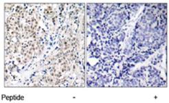 Anti-MYC Rabbit Polyclonal Antibody