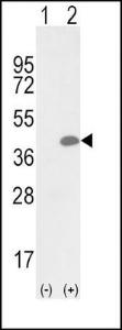 Anti-LOX1 Rabbit Polyclonal Antibody (Biotin)