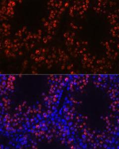 Anti-Histone H1 antibody