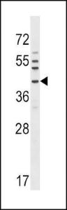 Anti-NKX6-1 Rabbit Polyclonal Antibody (FITC (Fluorescein Isothiocyanate))