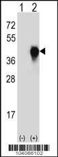 Anti-PLAUR Rabbit Polyclonal Antibody (PE (Phycoerythrin))