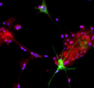 View of mixed neuron/glial cultures stained with Anti-Aldolase C Antibody (green) and Anti-NeuN/FOX3 Antibody (A85403 / red)