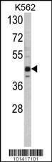 Anti-SETD8 Rabbit Polyclonal Antibody (FITC (Fluorescein))