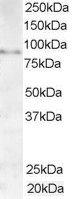 Anti-AKAP3 Antibody (A84013) (1 µg/ml) staining of Human Testis lysate (35 µg protein in RIPA buffer). Primary incubation was 1 hour. Detected by chemilu minescence