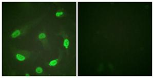 Immunofluorescence analysis of HeLa cells using Anti-p53 (acetyl Lys379) Antibody. The right hand panel represents a negative control, where the antibody was pre-incubated with the immunising peptide.