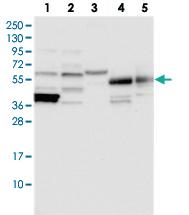 Anti-SUPT7L Rabbit Polyclonal Antibody