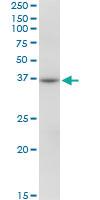 Anti-RHOXF2 Mouse Polyclonal Antibody