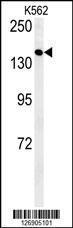 Anti-EGFR Rabbit Polyclonal Antibody (PE (Phycoerythrin))