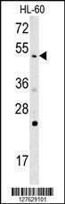 Anti-NOS1AP Rabbit Polyclonal Antibody