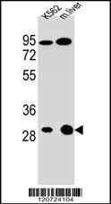 Anti-ETFA Rabbit Polyclonal Antibody