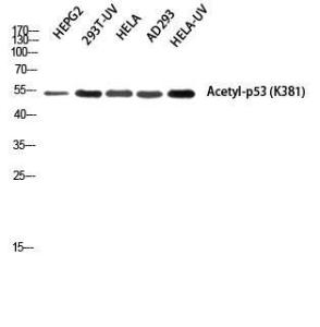 Western blot analysis of HEPG2 293T UV HELA AD293 HELA UV using Anti-p53 (acetyl Lys379) Antibody