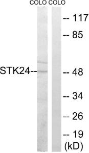 Western blot analysis of lysates from COLO cells using Anti-STK24 Antibody. The right hand lane represents a negative control, where the Antibody is blocked by the immunising peptide