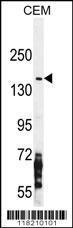 Anti-NOS2 Rabbit Polyclonal Antibody (AP (Alkaline Phosphatase))