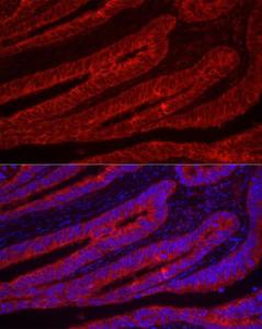 Antibody anti-TFF3 100 µl