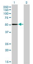 Anti-CFI Rabbit Polyclonal Antibody