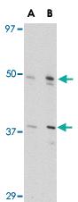 Anti-FEZ2 Rabbit Polyclonal Antibody