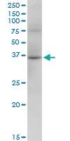 Anti-RHOXF2 Mouse Polyclonal Antibody