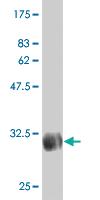 Anti-SLC46A2 Mouse Monoclonal Antibody [clone: 2F7]