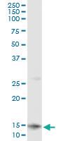 Anti-CLPS Antibody Pair