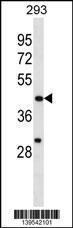 Anti-EGLN1 Rabbit Polyclonal Antibody (FITC (Fluorescein Isothiocyanate))